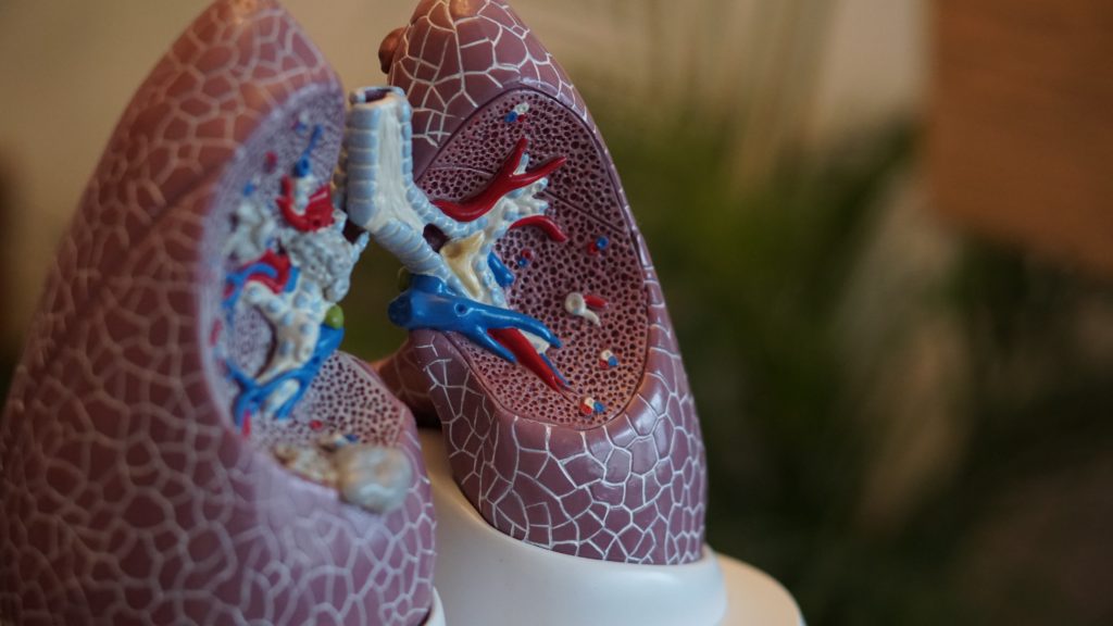 Air pollution is linked to childhood pneumonia