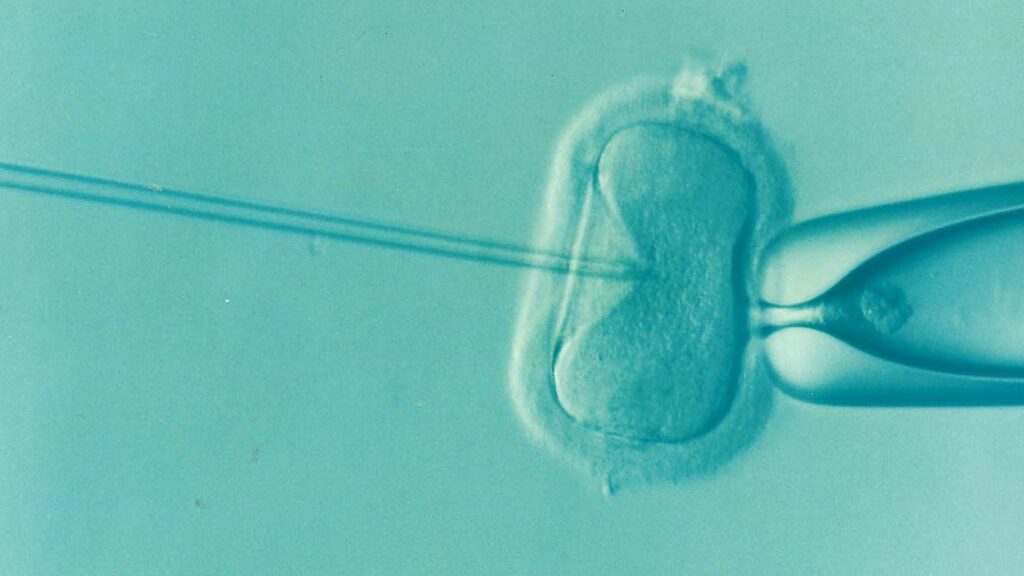 Effectiveness of IVF compromised by poor air quality