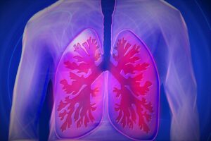 How air pollution rewires the immune system toward allergy and asthma