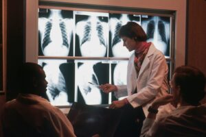 How air pollution contributes to lung cancer in non-smokers