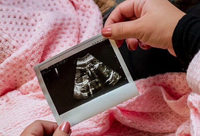 Air pollution in early pregnancy could increase depression risk