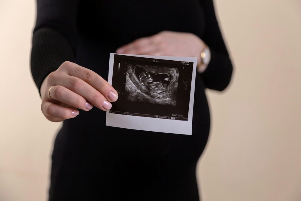 A mix of air pollutants in early pregnancy linked to risk of premature birth