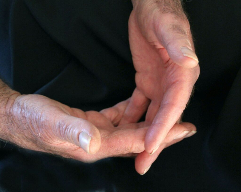 Air pollution linked to rheumatoid arthritis flare-ups, study finds
