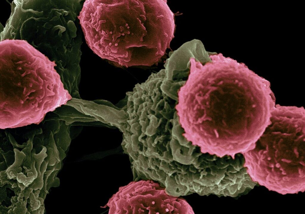 Blood markers reveal how air pollution may lead to lung cancer