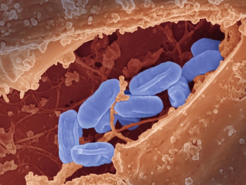 Mitochondria offer new clue to how air pollution harms the heart