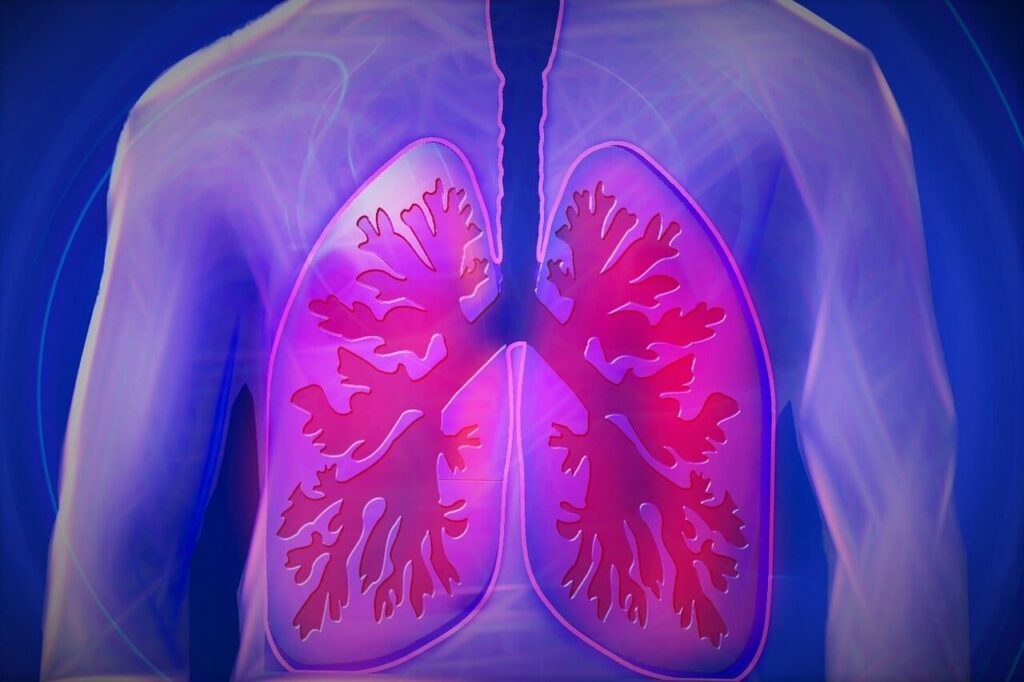 Microplastics found in higher levels in lung cancer patients
